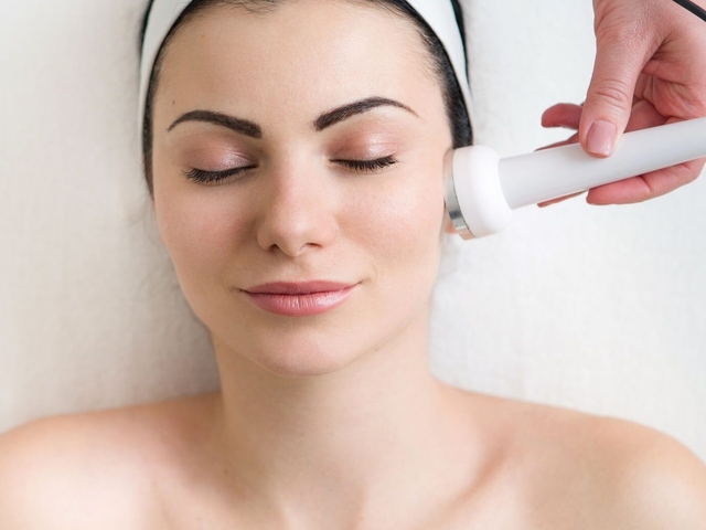 Laser treatments - photorejuvenation